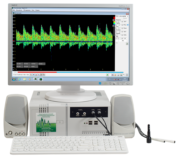 Допплеровский анализатор