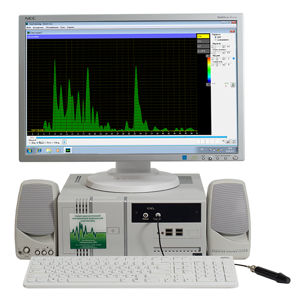 Синусограф